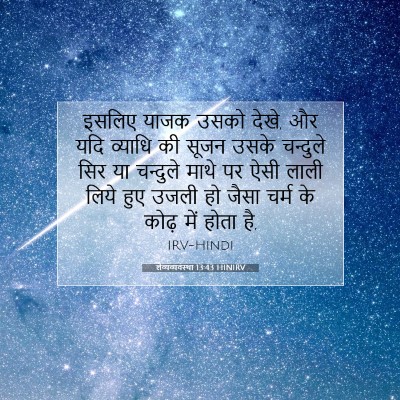 लैव्यव्यवस्था 13:43 HINIRV बाइबल आयत इमेज